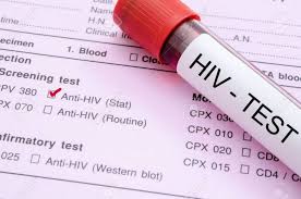 Tanzania lowers legal age for HIV/AIDS self-testing to 15