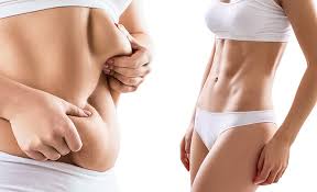 Slim down your tummy with Tummy Tuck